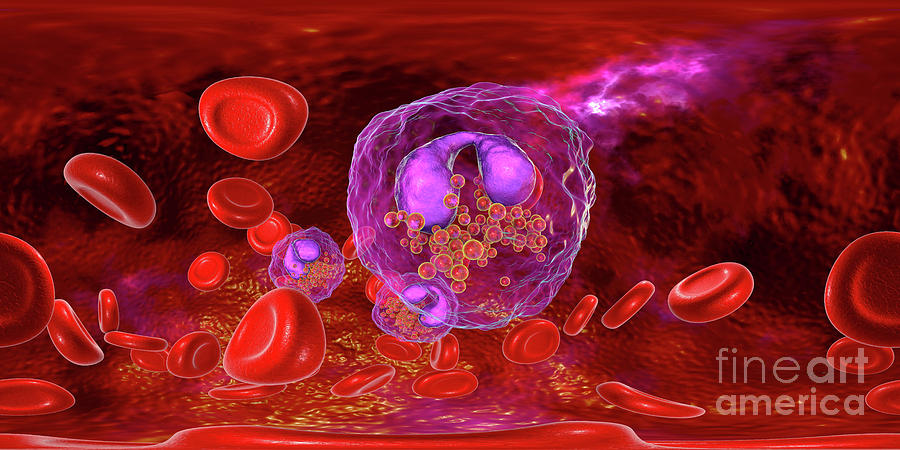 Blood Smear With Numerous Eosinophils Photograph By Kateryna Kon 