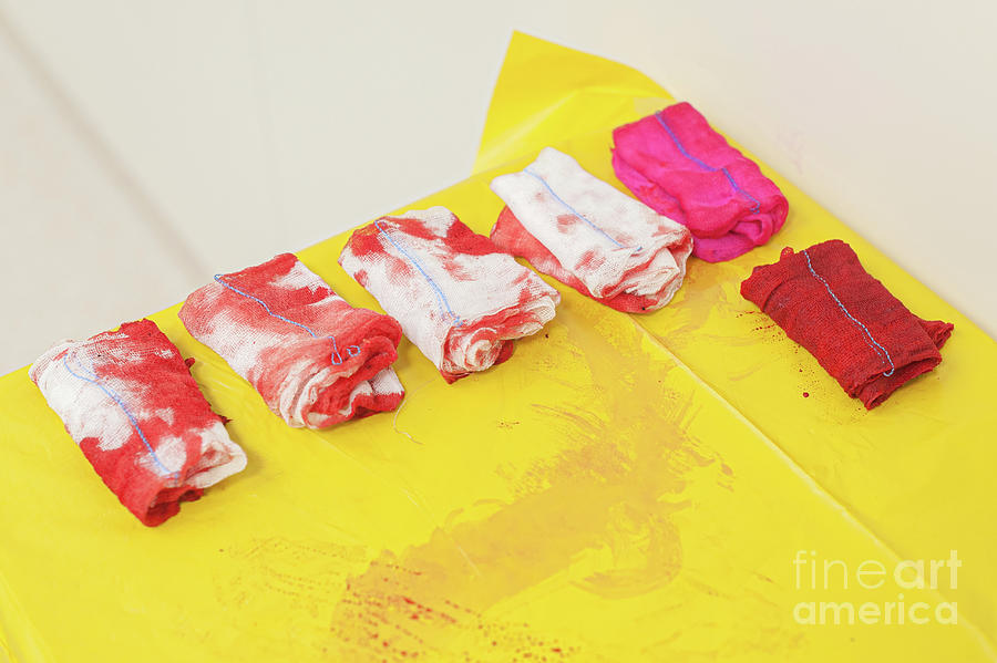 Blood-stained Dressings Used In Surgery Photograph by Arno Massee/science Photo Library