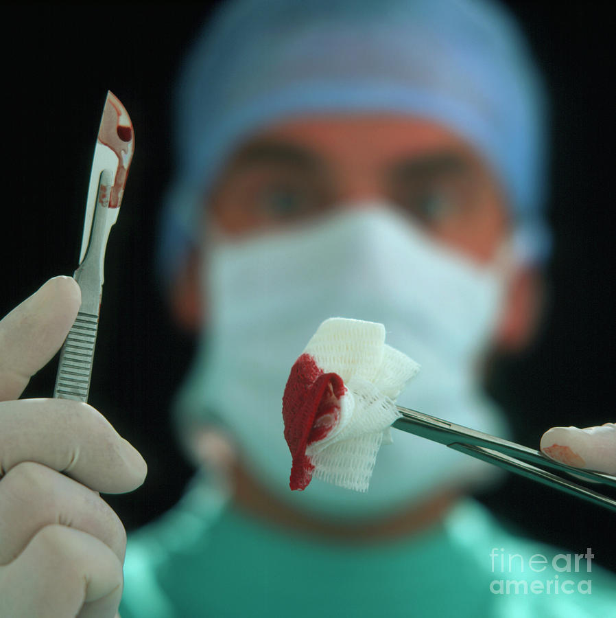 Blood-stained Scalpel & Gauze Held By Surgeon Photograph by Saturn Stills/science Photo Library