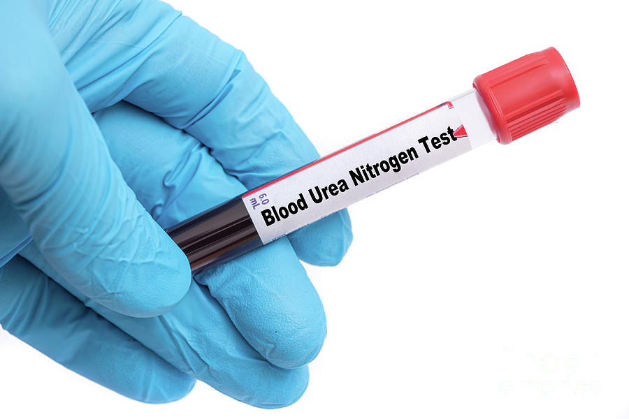 Blood Urea Nitrogen Test Photograph by Wladimir Bulgar/science Photo ...