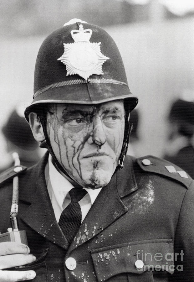 Bloodied Inspector Dennis Bell During Photograph by Bettmann