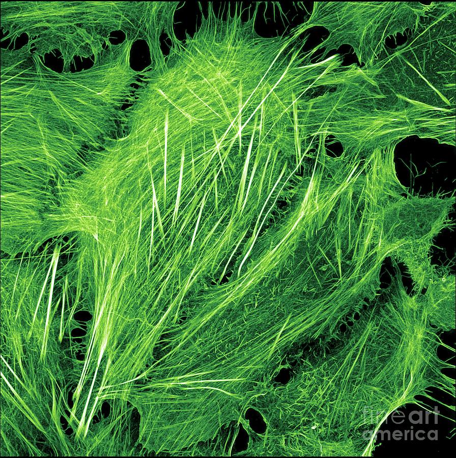Bone Cancer Cell Showing Cytoskeleton Photograph by Howard Vindin, The University Of Sydney/science Photo Library