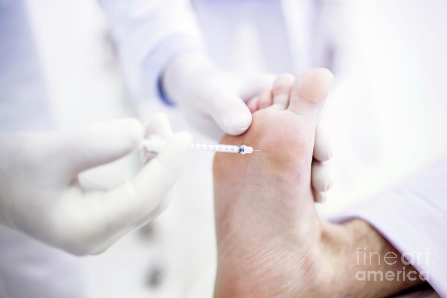 Botox Injection In Feet Photograph by Science Photo Library