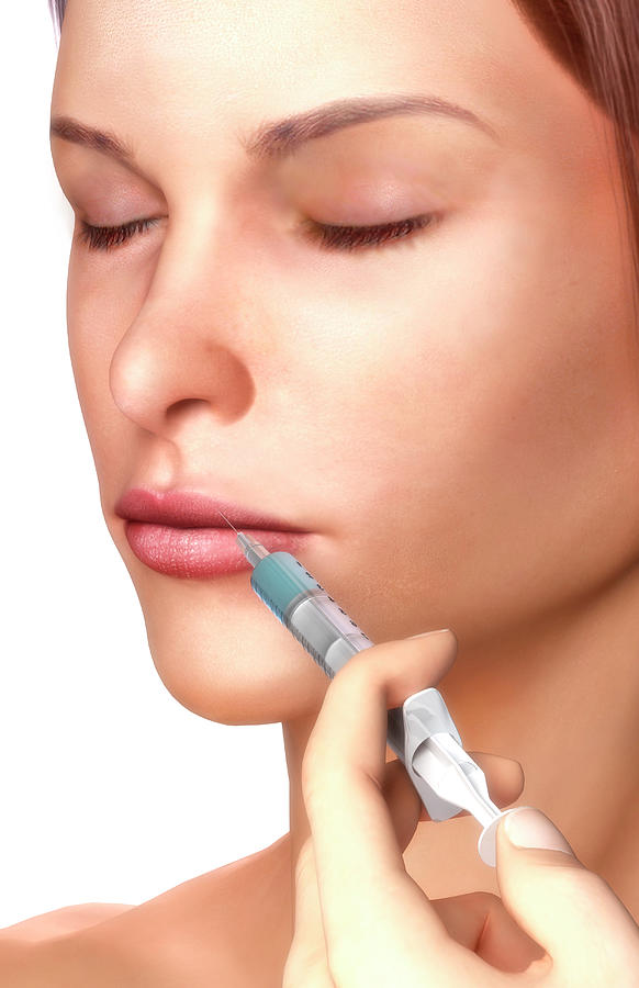 Botox Injection Digital Art by Medicalrf.com