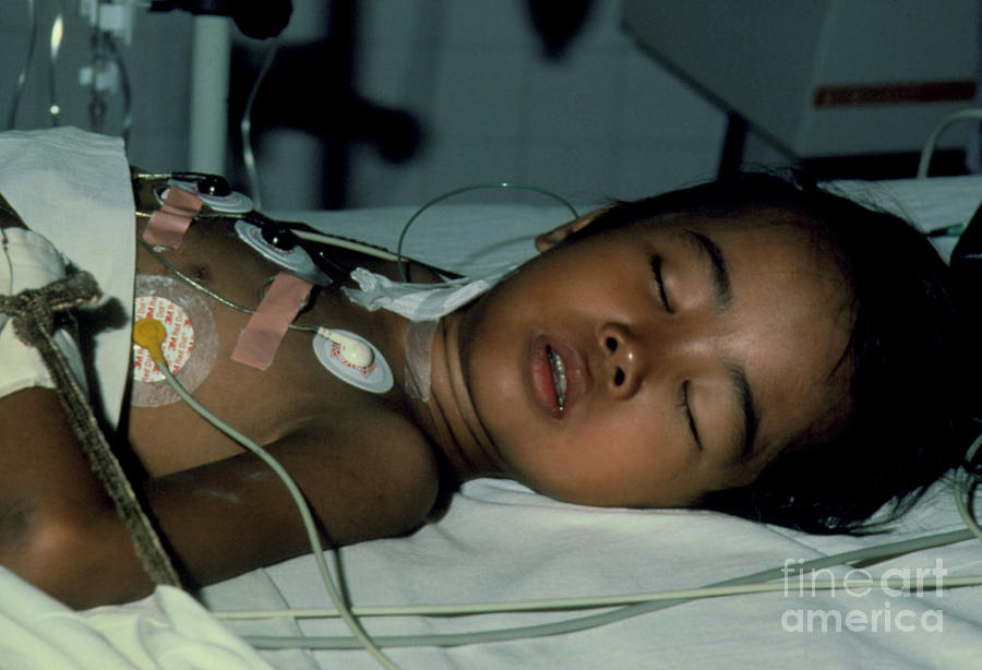 Boy With Diphtheria In Intensive Care Photograph by Sue Ford/science Photo Library
