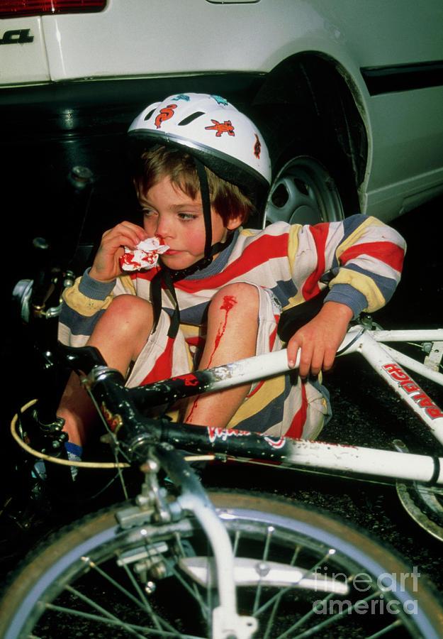 Boy With Nosebleed & Grazed Knee After Bike Fall Photograph by Mark Clarke/science Photo Library