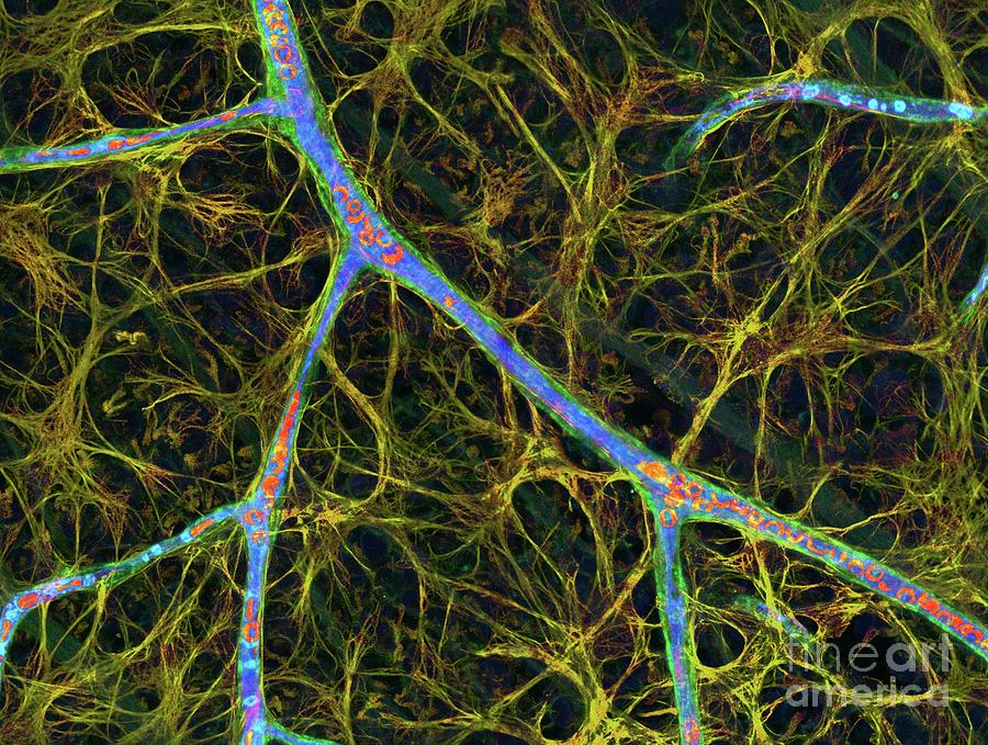 Brain Blood Vessels Photograph by Thomas Deerinck, Ncmir/science Photo ...