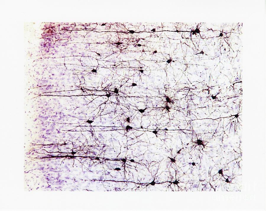 Brain Cells And Fibres Photograph by National Institute On Drug Abuse, National Institutes Of Health/miles Herkenham, Nimh/science Photo Library