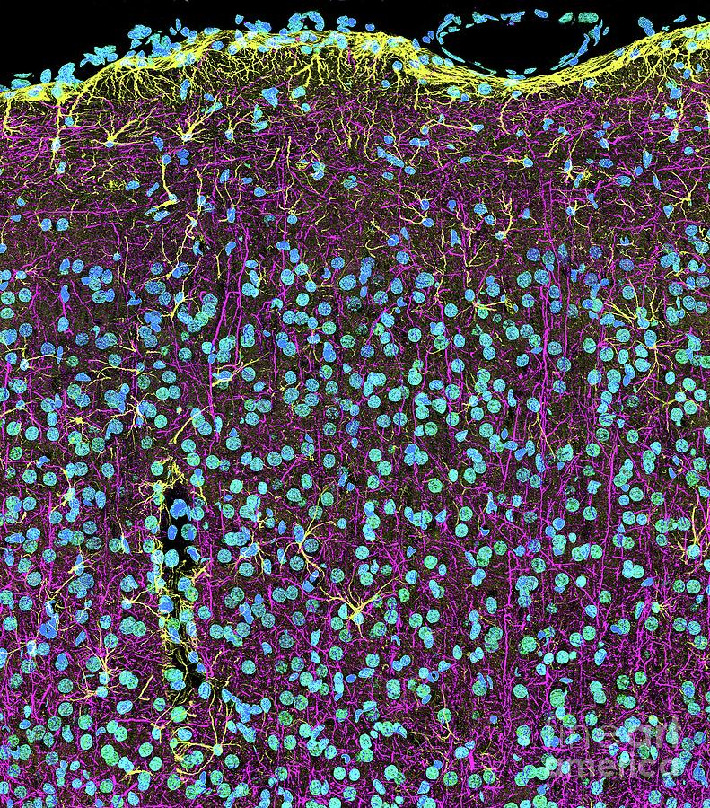 Brain Cortex Tissue Photograph by Thomas Deerinck, Ncmir/science Photo Library