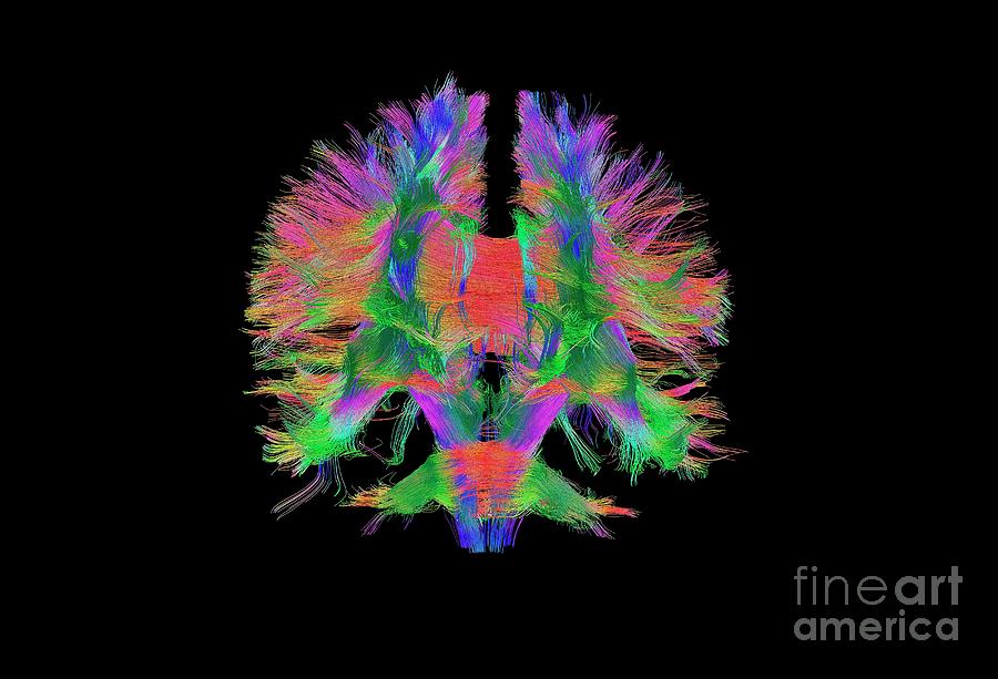 Brain Fibres Front View Photograph by Do Tromp/science Photo Library