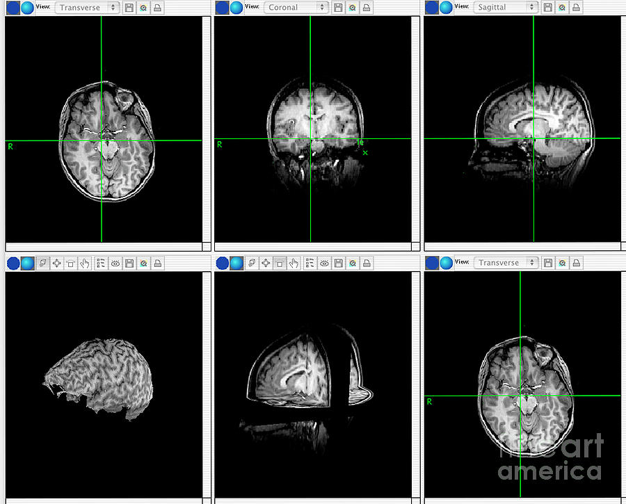 Brain Mapping Scans Photograph by University Of Durham/simon Fraser