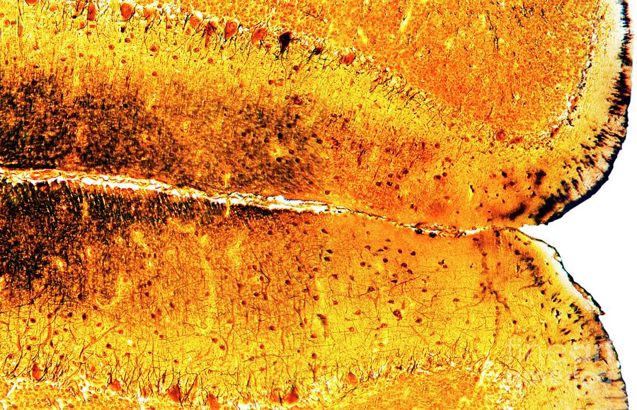 Brain Tissue Photograph by Dr Keith Wheeler/science Photo Library