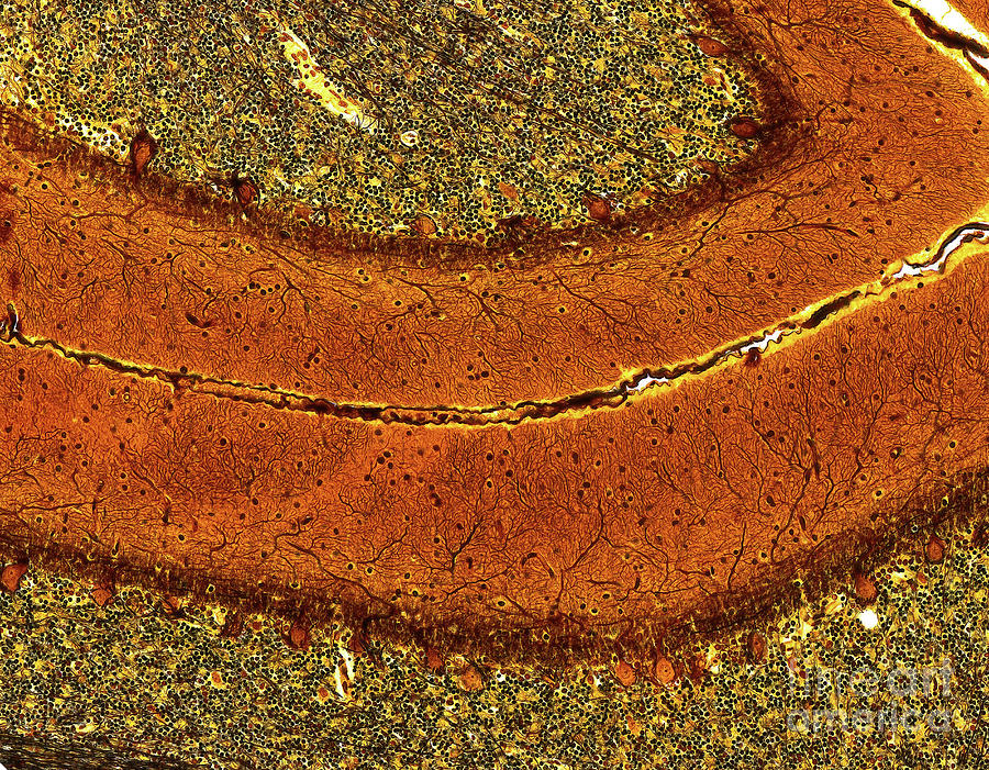 Brain Tissue Photograph by Microscape/science Photo Library