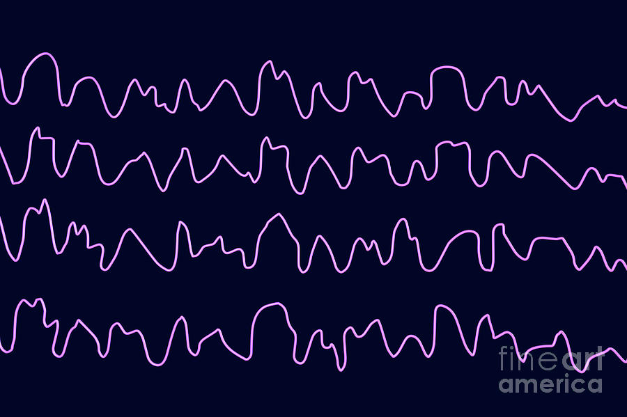 Brain Waves Animated