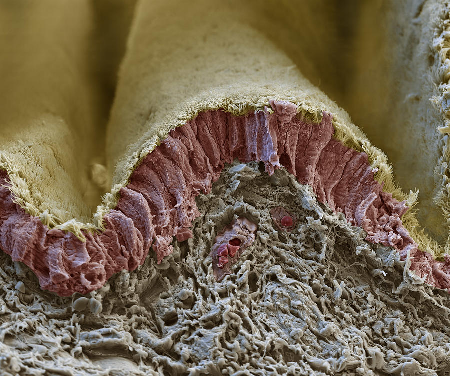 Bronchus Cross Section, Sem Photograph By Meckes/ottawa