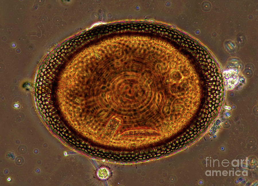 Bryozoan Egg Photograph by Marek Mis/science Photo Library