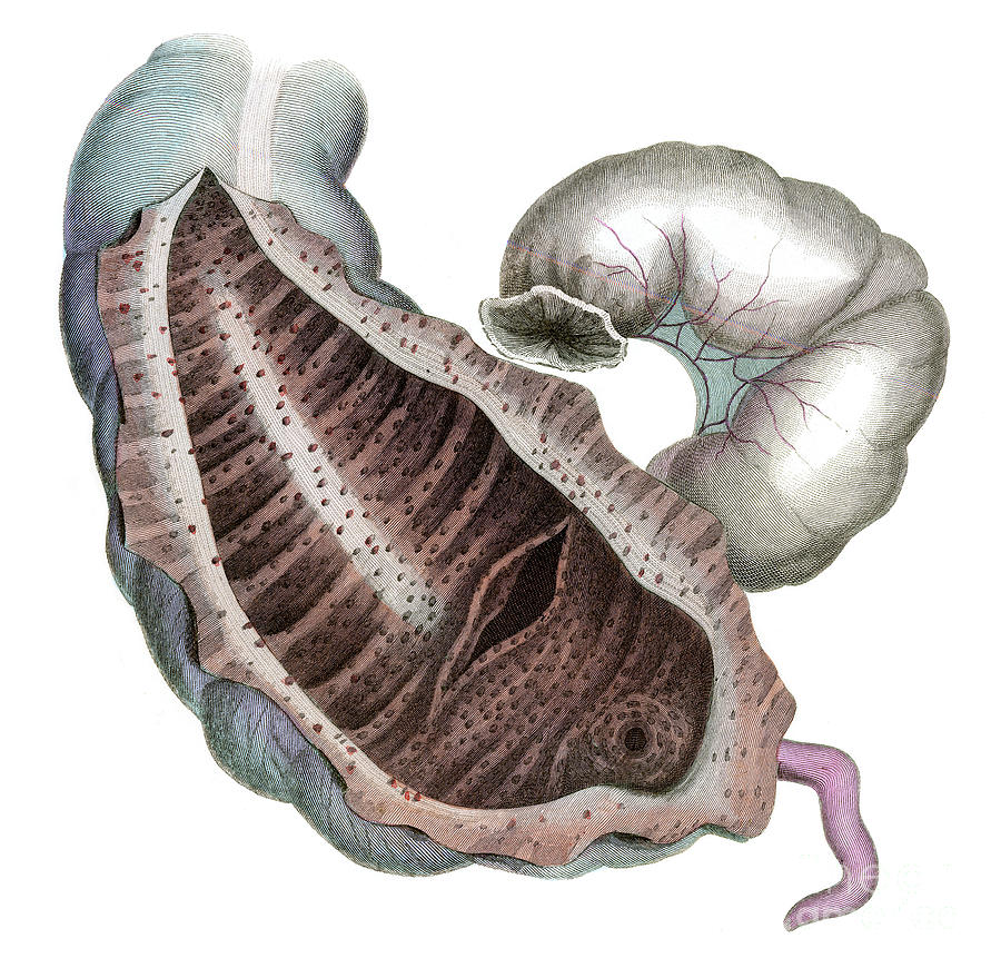 Caecum And Colon Photograph by Microscape/science Photo Library - Pixels