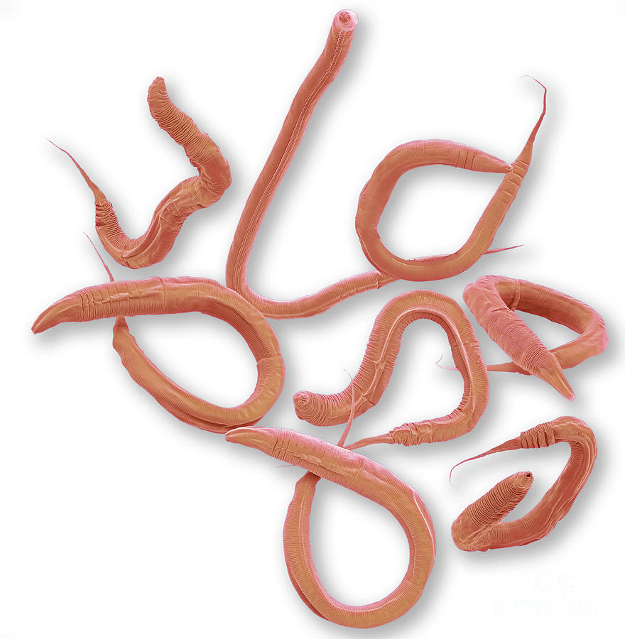 Caenorhabditis Elegans Worms Photograph by Steve Gschmeissner/science ...