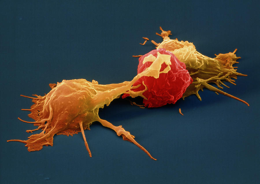 Cancer Attacked By Natural Killer Cells Photograph by Oliver Meckes EYE OF SCIENCE