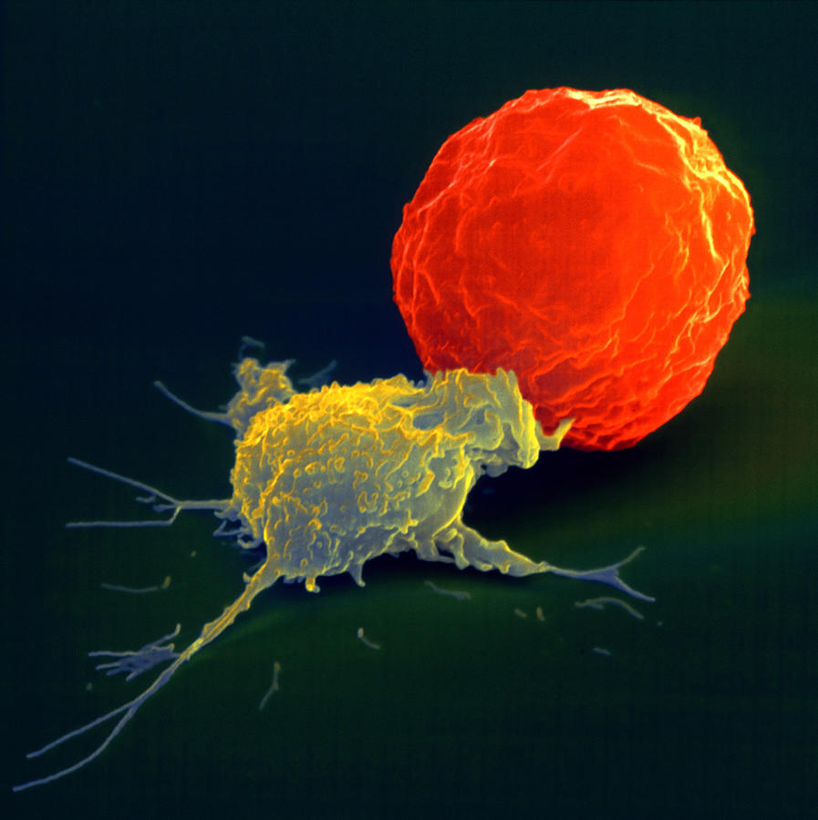 Cancer Cell Attacked By Killer Cell Photograph by Oliver Meckes EYE OF SCIENCE
