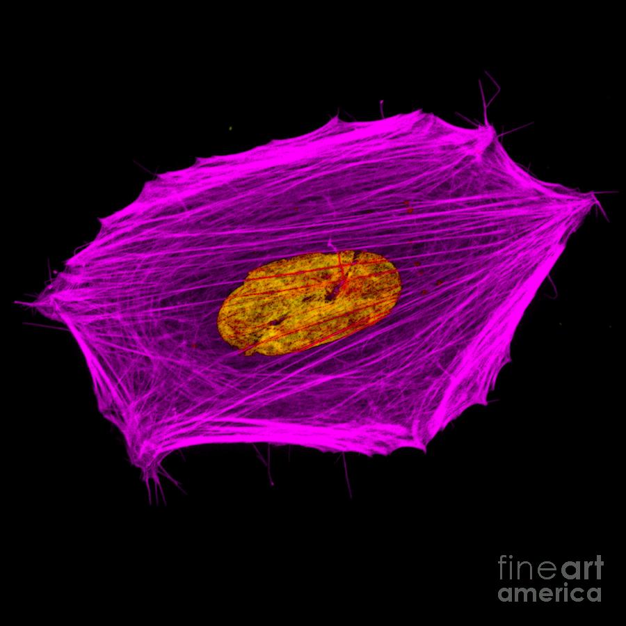 Cancer Cell Cytoskeleton And Nuclei Photograph by Howard Vindin, The University Of Sydney/science Photo Library