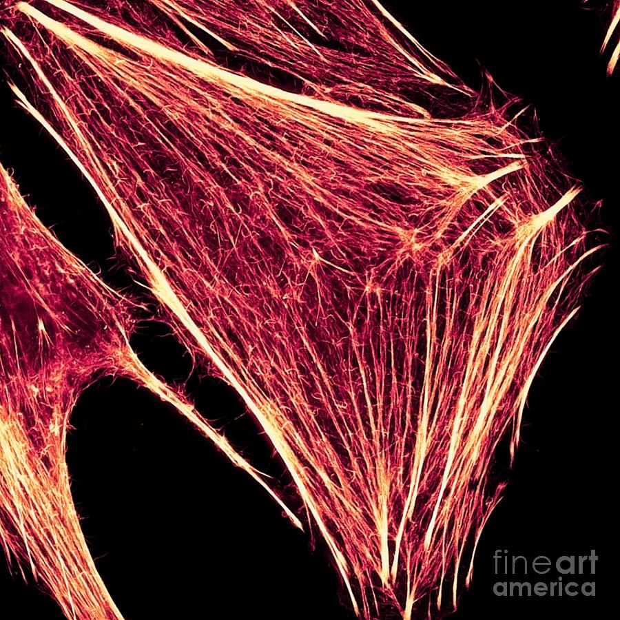 Cancer Cell Super Resolution Cytoskeleton Photograph by Howard Vindin, The University Of Sydney/science Photo Library