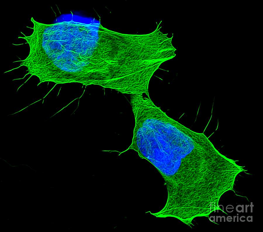 Cancer Cells After Drug Treatment Photograph by Howard Vindin, The University Of Sydney/science Photo Library