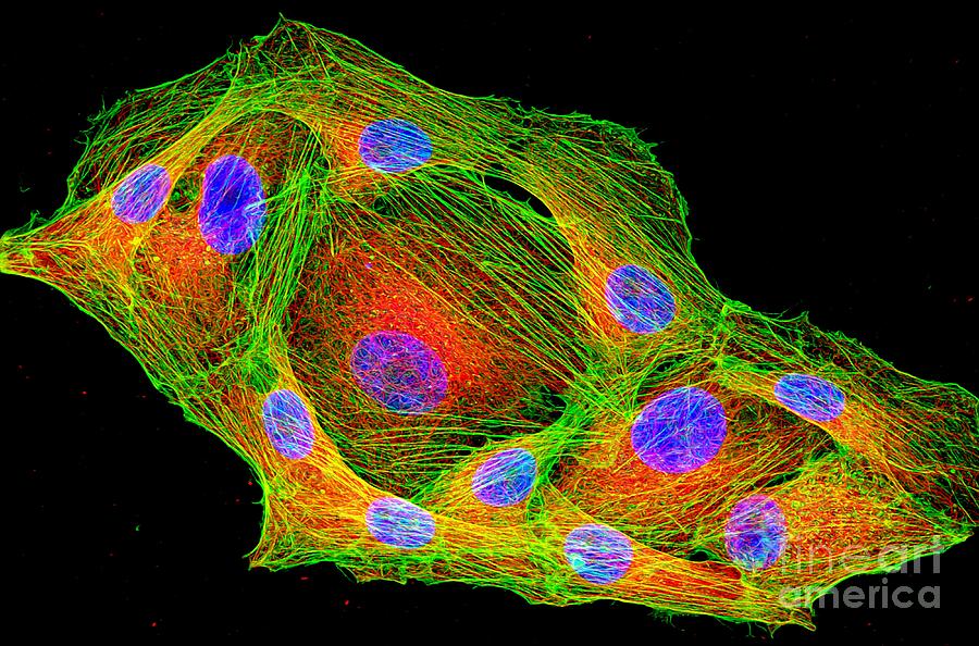 Cancer Cells Cytoskeleton And Nuclei Photograph by Howard Vindin, The University Of Sydney/science Photo Library