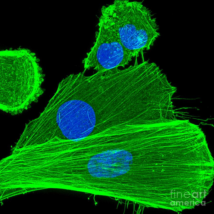 Cancer Cells Nuclei And Actin Photograph by Howard Vindin, The University Of Sydney/science Photo Library