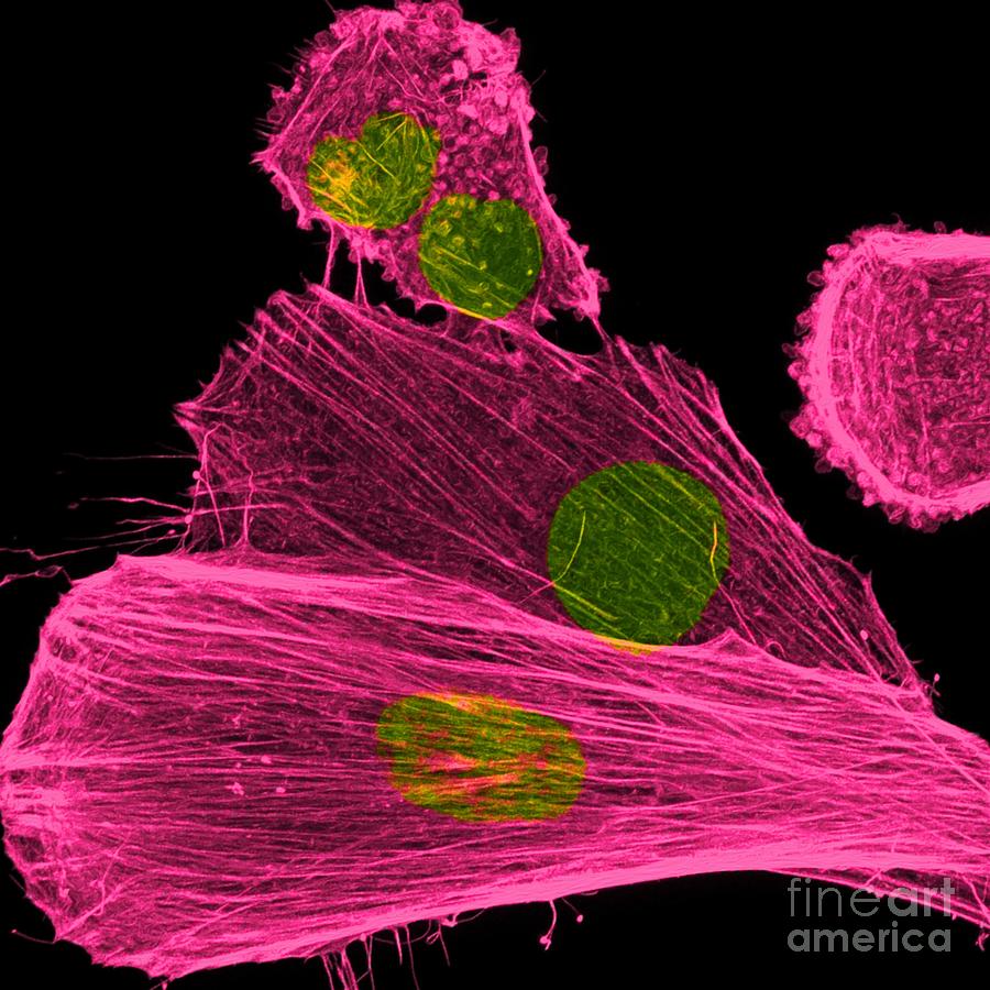 Cancer Cells Nuclei And Cytoskeleton Photograph by Howard Vindin, The University Of Sydney/science Photo Library