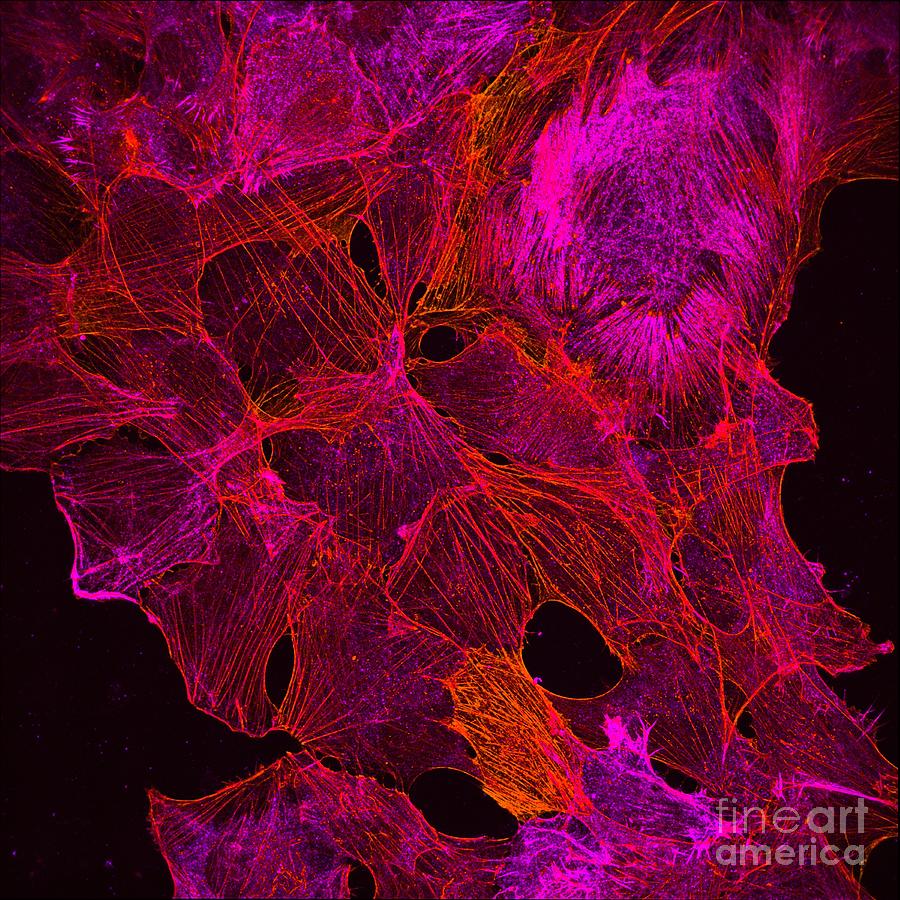 Cancer Cells Showing Actin Cytoskeleton Photograph by Howard Vindin, The University Of Sydney/science Photo Library