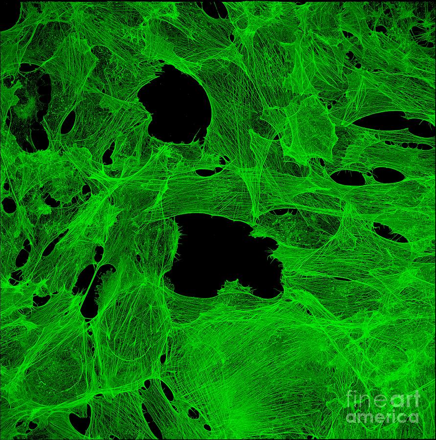 Cancer Cells Showing Cytoskeleton Photograph by Howard Vindin, The University Of Sydney/science Photo Library