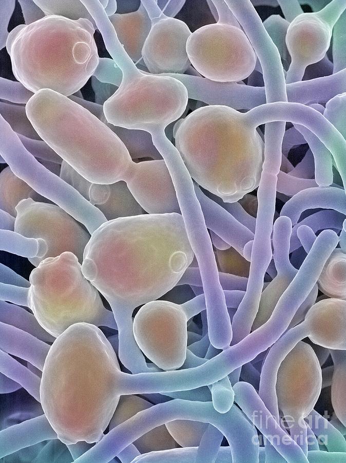 Candida Albicans Yeast And Hyphae Photograph by Dennis Kunkel Microscopy/science Photo Library
