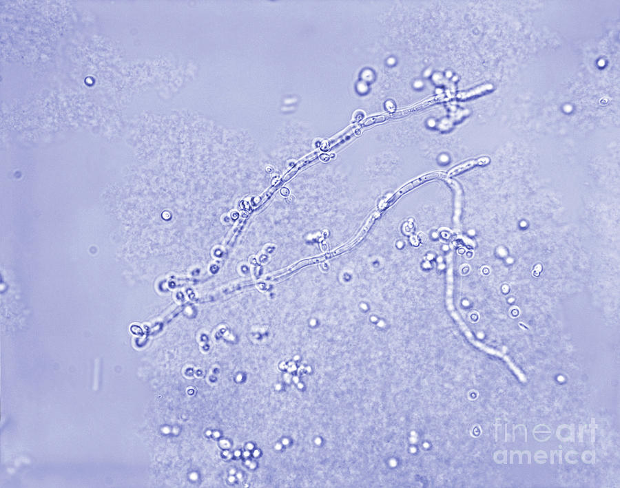 Candidiasis Albicans Fungus Photograph By Cdcscience Photo Library Fine Art America 3798