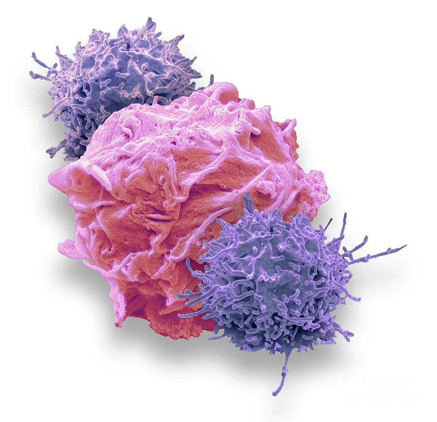 Car T-cell Immunotherapy Photograph by Steve Gschmeissner/science Photo ...