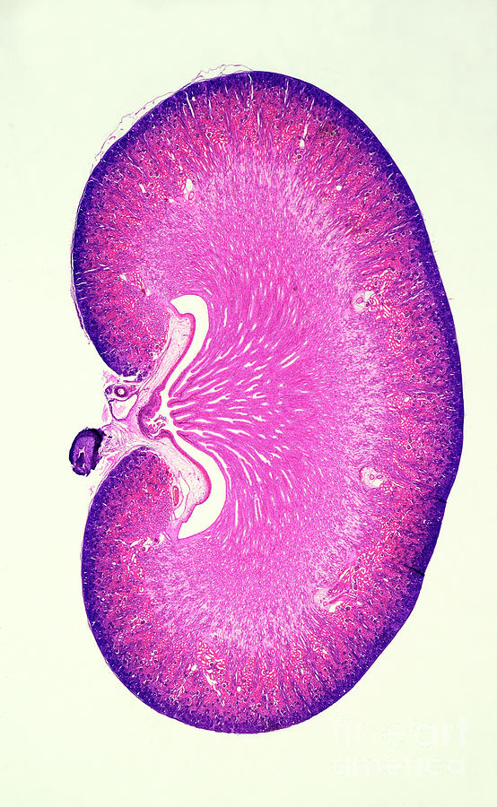 Cats Kidney Photograph by Nigel Downer/science Photo Library