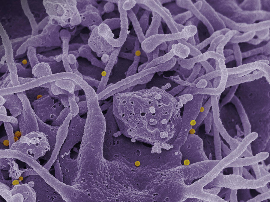 Cchf Virus, Sem Photograph by Science Source