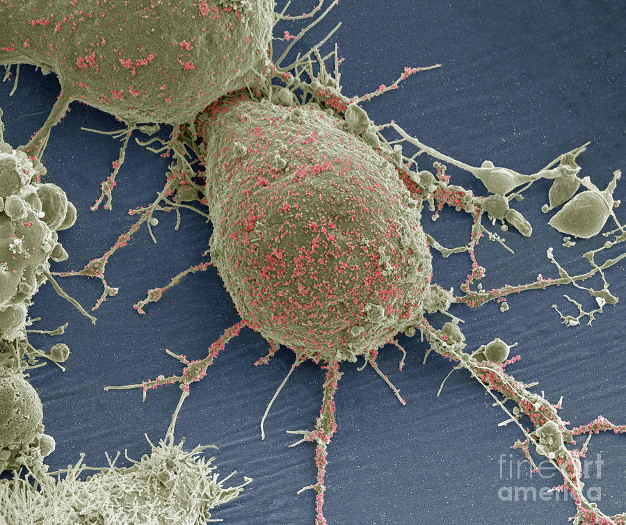 Cell Infected With Hiv Photograph by Thomas Deerinck, Ncmir/science Photo Library