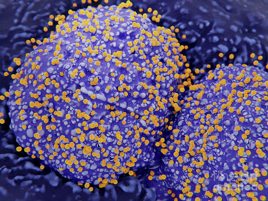 Coronavirus Photograph - Cells Infected With Coronavirus by Juan Gaertner/science Photo Library