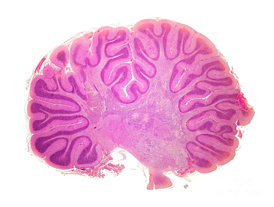 Cerebellum Photograph by Dr Keith Wheeler/science Photo Library