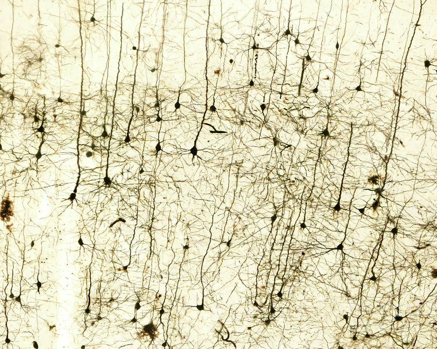 Cerebral Cortex Pyramidal Cells Photograph by Jose Calvo / Science Photo Library