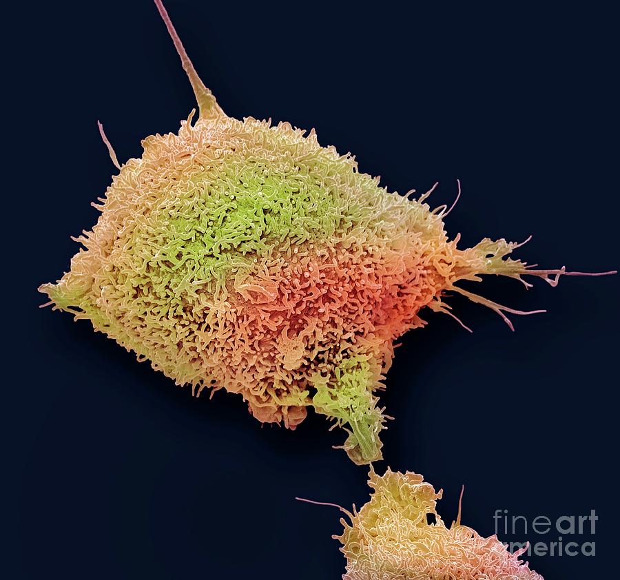 Cervical Cancer Cell Photograph by Steve Gschmeissner/science Photo Library