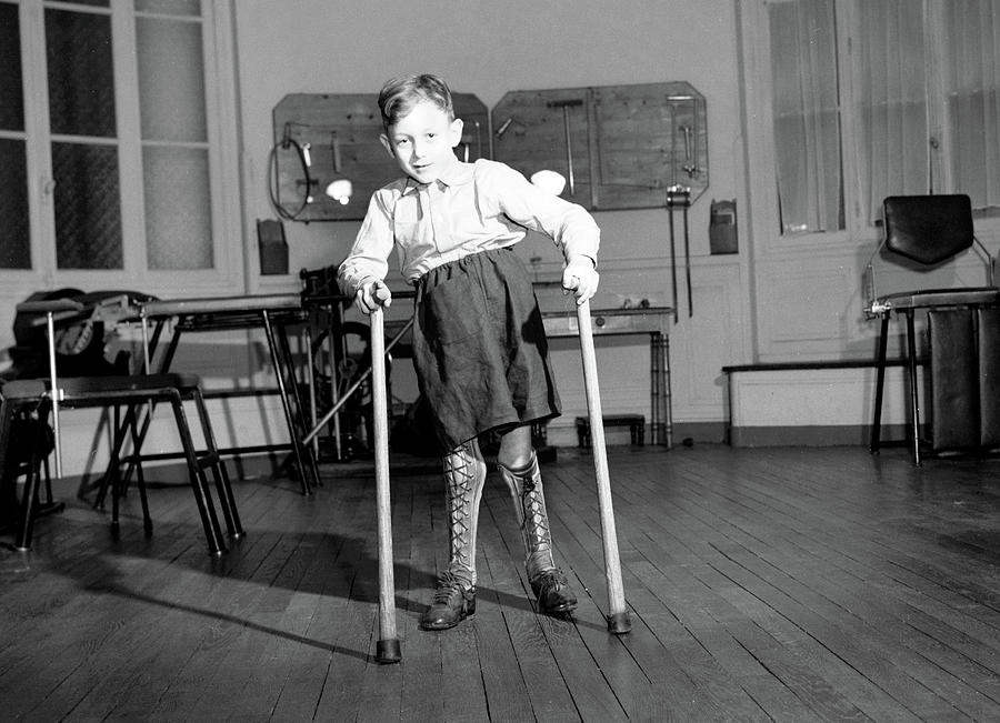 Child With Polio In Clinic, C. 1950 Photograph by Science Source - Fine ...