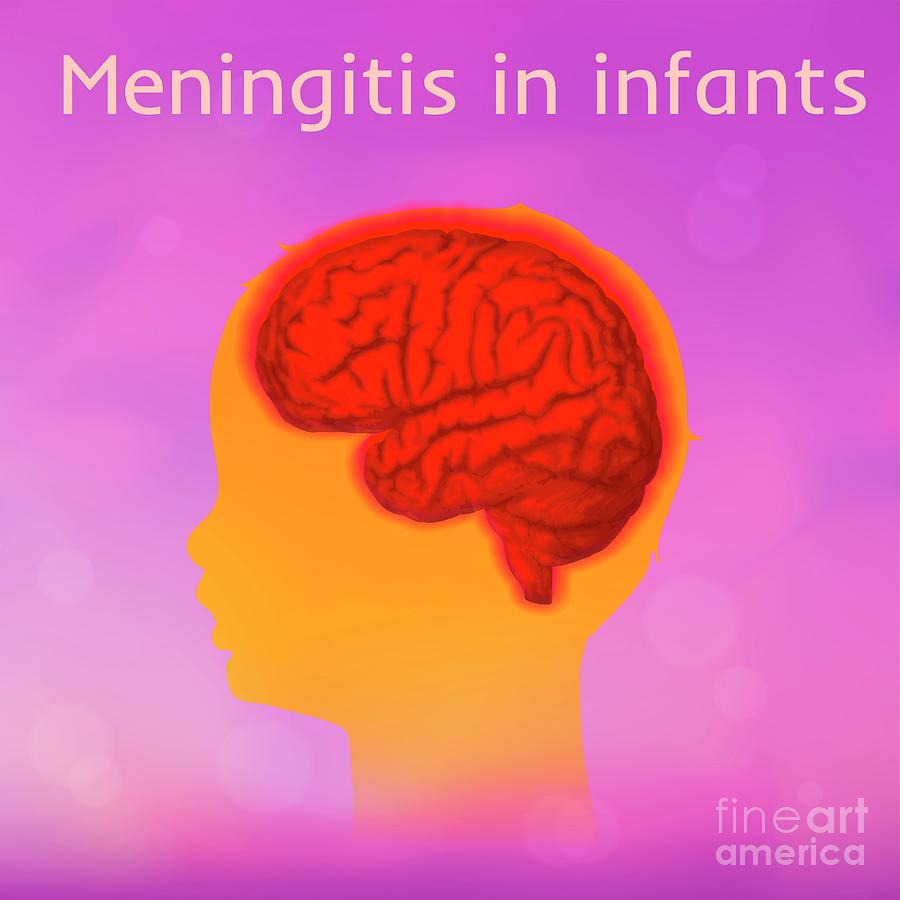 Childhood Meningitis Photograph By Veronika Zakharova/science Photo Library