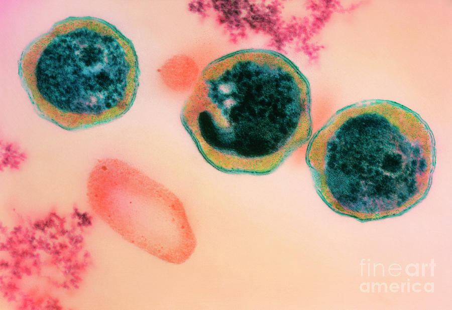 Хламидиоз возбудитель инфекции. Хламидия пневмония под микроскопом. Хламидии форма бактерии.