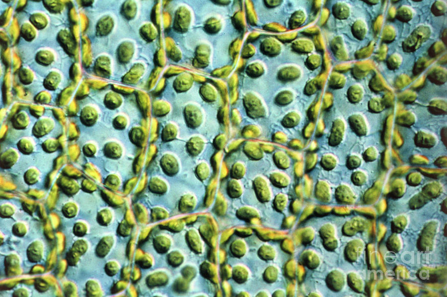 Chloroplasts Photograph by Biophoto Associates/science Photo Library ...