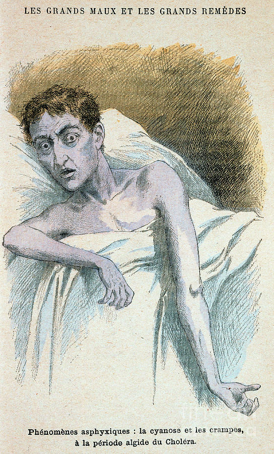 Cholera Patient Drawing by Print Collector