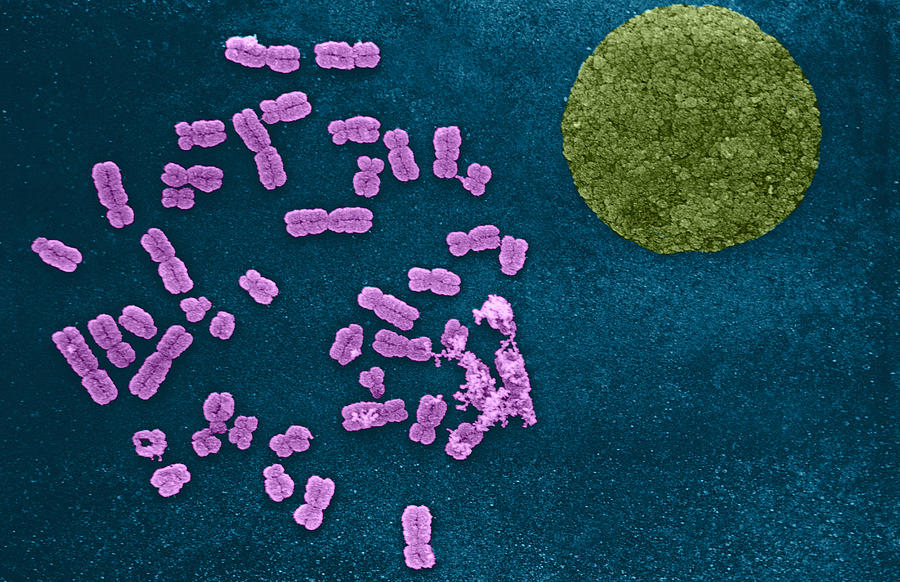 Chromosomes And Nucleus Photograph by Biophoto Associates