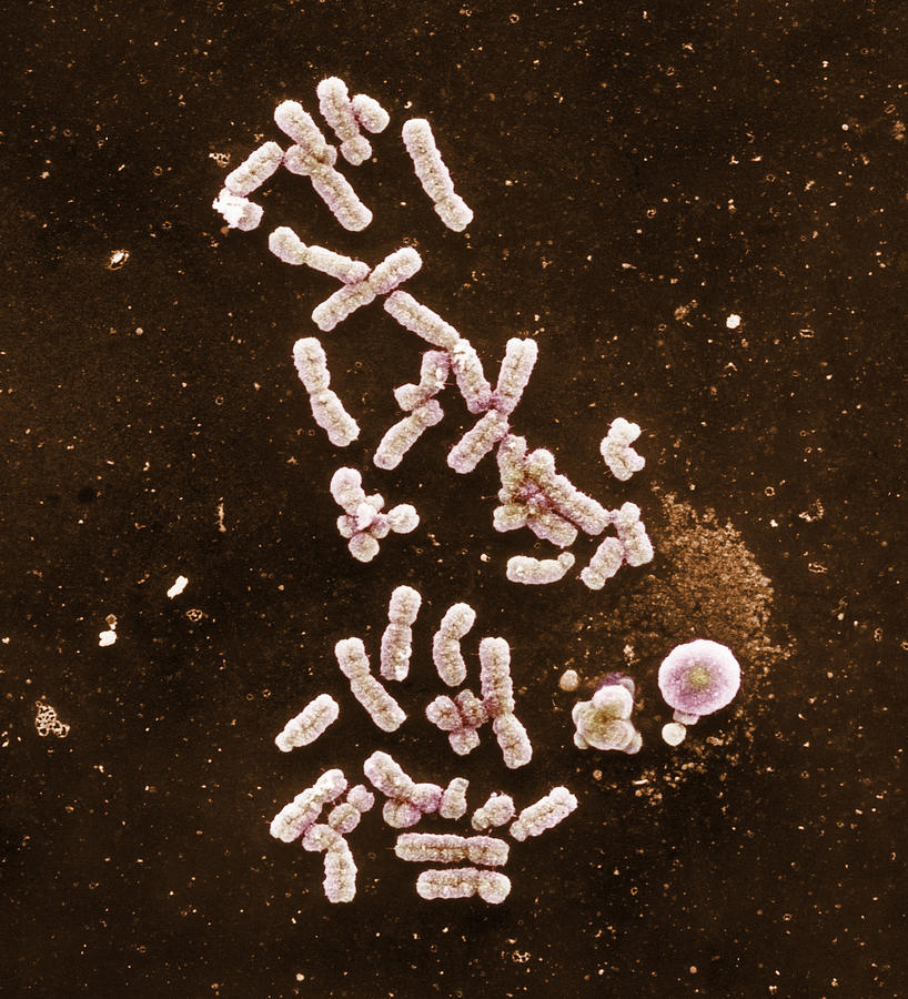 Chromosomes, Sem Photograph by Biophoto Associates