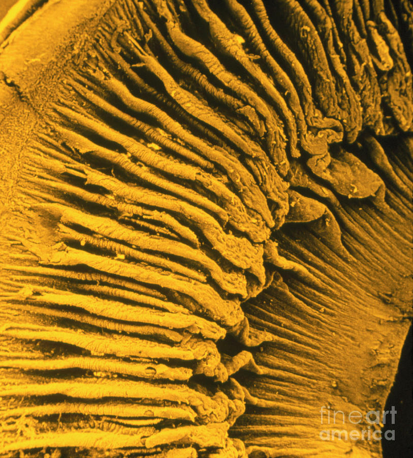 Ciliary Body And Iris Of The Eye Photograph by Cnri/science Photo Library